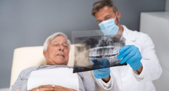 Overcoming Bone Loss with All-on-4 Dental Implants
