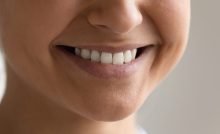 Close up of a smiling female who is happy with recent dental procedure.